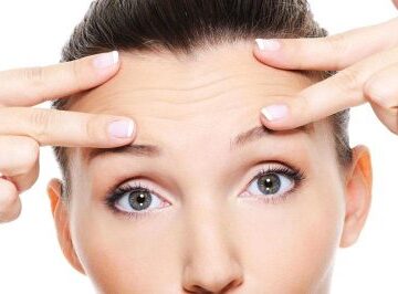 Alın Dolgu Tedavisi