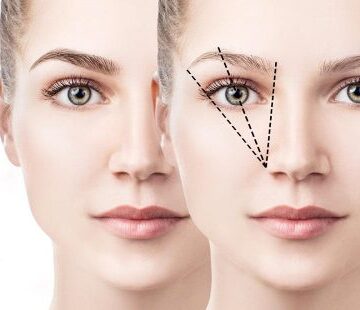 Fransız Askısı ile Kaş Kaldırma