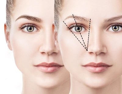 Fransız Askısı ile Kaş Kaldırma