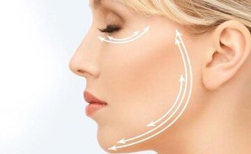 İğneli Radyofrekans ile İnce Çizgi Tedavisi