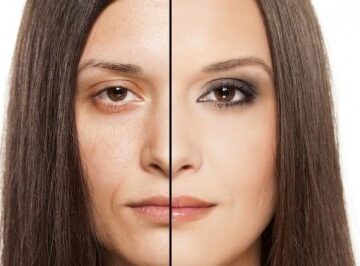 Lazerle Cilt Gençleştirme