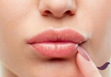 Plazma Pen ile Dudak Kaldırma