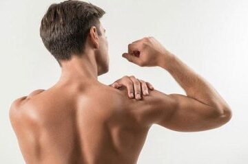 Sırt Lazer Epilasyon