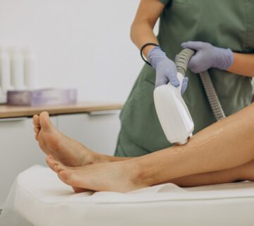 Buz lazer epilasyon 1 360x320