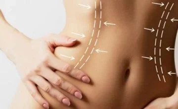 Kavitasyon bolgesel zayiflama