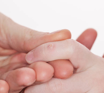 Ben ve sigil aldirma