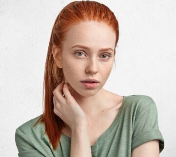 kızıl-tüylere-lazer-epilasyon