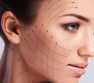 Ankara ameliyatsiz iple yuz germe tedavisi