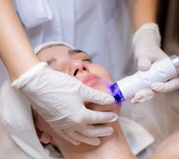 yüz-lazer-epilasyon-sonrasi-cilt-bakimi