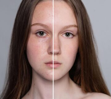 Cilt tonu esitleme 360x320