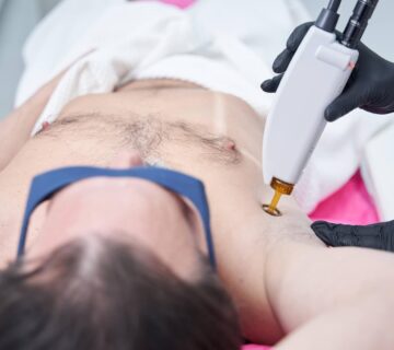 Gogus lazer epilasyon 360x320