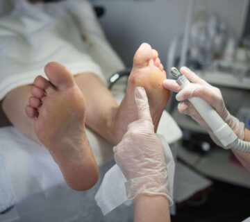 Nasir tedavisi 360x320