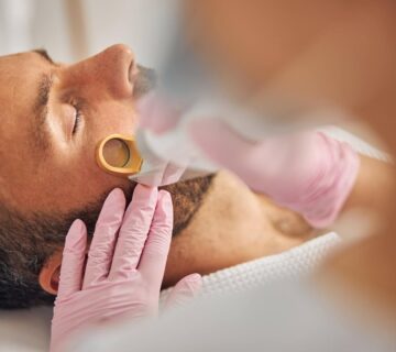 Sakal ustu lazer epilasyon 360x320