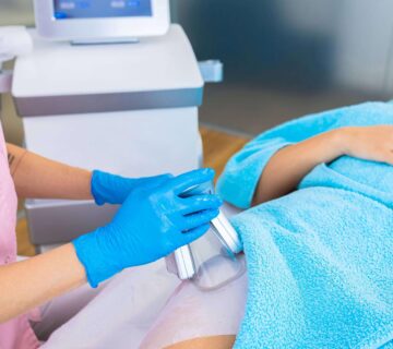 Soguk lipoliz ile selulit tedavisi 360x320