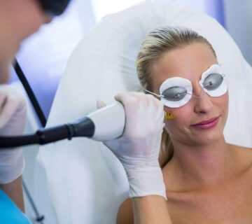 Yuz lazer epilasyon 360x320