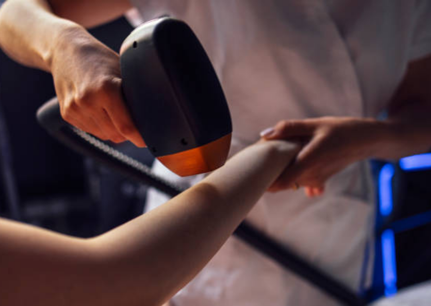 Lazer epilasyon atis derecesi kac olmali