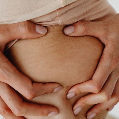 Mezoterapinin selulite etkisi ve uygulama alanlari